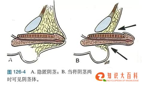 阴茎龟头|人类阴茎